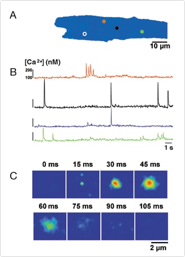 calcium-visible-light.par.57492.image.360.500.1.s001584-calcium-ventricular-myocyte-gif calcium-visible-light.par.57492.image.360.500.1.s001584-calcium-ventricular-myocyte-gif