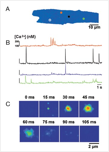 calcium-visible-light.par.57492.image.360.500.1.s001584-calcium-ventricular-myocyte-gif calcium-visible-light.par.57492.image.360.500.1.s001584-calcium-ventricular-myocyte-gif