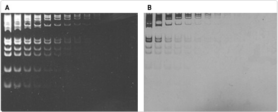 nucleic-acid-detection-electrophoretic-gels.par.20935.image.559.226.1.s001023-sybr-gold-stain-gif nucleic-acid-detection-electrophoretic-gels.par.20935.image.559.226.1.s001023-sybr-gold-stain-gif