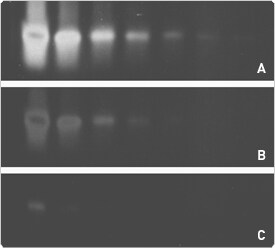 nucleic-acid-detection-electrophoretic-gels.par.92662.image.275.248.1.s000176-oligonucleotide-detection-gif nucleic-acid-detection-electrophoretic-gels.par.92662.image.275.248.1.s000176-oligonucleotide-detection-gif