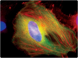 probes-actin.par.90080.image.275.204.1.s006947-actin-gif probes-actin.par.90080.image.275.204.1.s006947-actin-gif