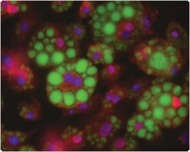 LipidTOX 绿色中性脂质染色剂和脂肪酸结合蛋白(FABP4)抗体标记脂肪细胞 LipidTOX 绿色中性脂质染色剂和脂肪酸结合蛋白(FABP4)抗体标记脂肪细胞