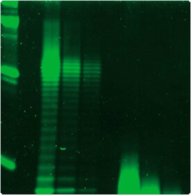sphingolipids-steroids-lipopolysaccharides.par.71568.image.275.280.1.s001785-lipopolysaccharide-staining-gif sphingolipids-steroids-lipopolysaccharides.par.71568.image.275.280.1.s001785-lipopolysaccharide-staining-gif
