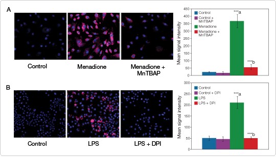 reactive-oxygen-species.par.77467.image.540.308.1.s007902-4-cellrox-ros-hcimaging-jpg reactive-oxygen-species.par.77467.image.540.308.1.s007902-4-cellrox-ros-hcimaging-jpg