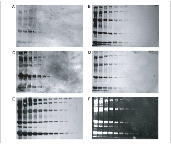 detection-total-protein-profile.par.73773.image.559.470.1.s001840-stains-proteins-blots-gif detection-total-protein-profile.par.73773.image.559.470.1.s001840-stains-proteins-blots-gif
