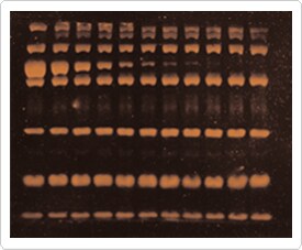 detection-total-protein-profile.par.72260.image.275.227.1.s001457-protein-detection-gif detection-total-protein-profile.par.72260.image.275.227.1.s001457-protein-detection-gif