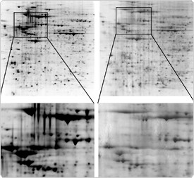 detection-total-protein-profile.par.78581.image.275.253.1.s001676-sypro-ruby-protein-gif detection-total-protein-profile.par.78581.image.275.253.1.s001676-sypro-ruby-protein-gif