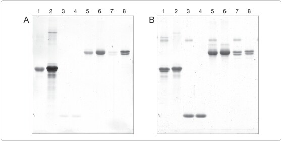 multiplexed-proteomics-technology.par.38847.image.559.279.1.s002041-phosphoprotein-gel-stain-gif multiplexed-proteomics-technology.par.38847.image.559.279.1.s002041-phosphoprotein-gel-stain-gif