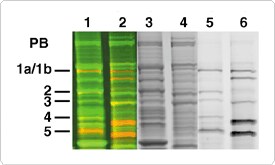 multiplexed-proteomics-technology.par.49857.image.275.165.1.s001779-penicillin-binding-proteins-gif multiplexed-proteomics-technology.par.49857.image.275.165.1.s001779-penicillin-binding-proteins-gif