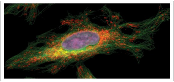 fluorescence-microscopy.par.95127.image.559.263.1.s007301-qdot-nanocrystals-gif fluorescence-microscopy.par.95127.image.559.263.1.s007301-qdot-nanocrystals-gif