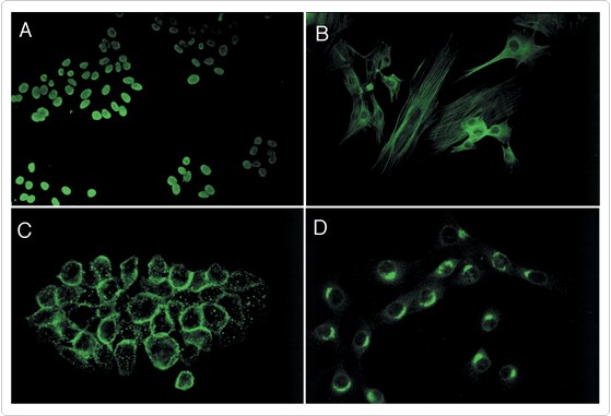 enzyme-labeled-fluorescence.par.92506.image.559.381.1.s000146-elf97-cytological-labeling-kit-gif enzyme-labeled-fluorescence.par.92506.image.559.381.1.s000146-elf97-cytological-labeling-kit-gif
