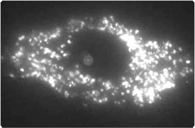 qdot-nanocrystals.par.1536.image.275.180.1.s002764-qdot-nanocrystals-cytoplasmic-gif qdot-nanocrystals.par.1536.image.275.180.1.s002764-qdot-nanocrystals-cytoplasmic-gif