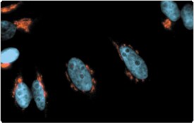 tyramide-signal-amplification.par.64871.image.275.175.1.s001363-golgi-hela-cells-gif tyramide-signal-amplification.par.64871.image.275.175.1.s001363-golgi-hela-cells-gif