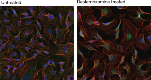 Immunofluorescence analysis of HIF-1α localization in HeLa cells after treatment with desferrioxamine Immunofluorescence analysis of HIF-1α localization in HeLa cells after treatment with desferrioxamine