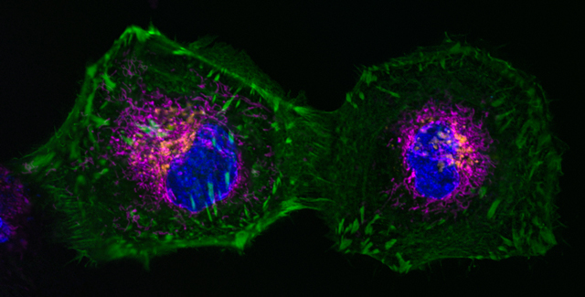 Multicolor live-cell imaging with ProLong Live Antifade Reagent Multicolor live-cell imaging with ProLong Live Antifade Reagent