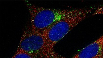 Multiplex immunocytochemical analysis using fluorescent Superclonal secondary antibodies Multiplex immunocytochemical analysis using fluorescent Superclonal secondary antibodies