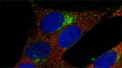 Multiplex immunocytochemical analysis using fluorescent Superclonal secondary antibodies Multiplex immunocytochemical analysis using fluorescent Superclonal secondary antibodies