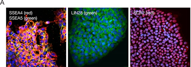 Immunofluorescence imaging of iPSCs Immunofluorescence imaging of iPSCs