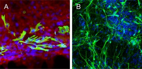 Characterization of astrocytes and dopaminergic (DA) neurons derived from PSCs Characterization of astrocytes and dopaminergic (DA) neurons derived from PSCs