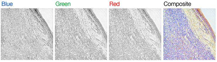Maxwell’s theory of color composition to histological staining Maxwell’s theory of color composition to histological staining