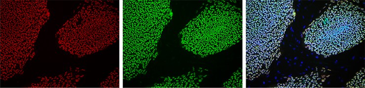 Fixed-cell immunostaining of human pluripotent stem cells (hPSCs) Fixed-cell immunostaining of human pluripotent stem cells (hPSCs)
