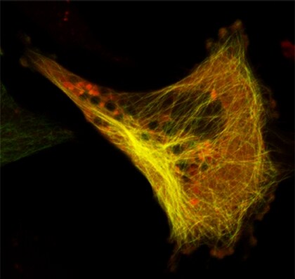 Localization of wild-type and mutant Tau fusion proteins Localization of wild-type and mutant Tau fusion proteins