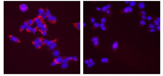 Absence of LC3B in CRISPR-Cas9–edited HAP1 cells after chloroquine treatment Absence of LC3B in CRISPR-Cas9–edited HAP1 cells after chloroquine treatment