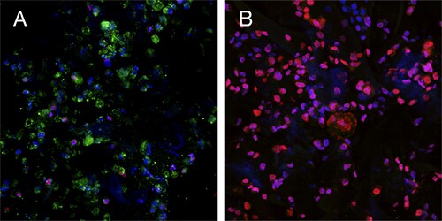 3d-cancer-fig1 3d-cancer-fig1