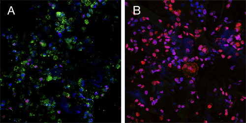 3d-cancer-fig1 3d-cancer-fig1