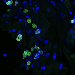 3d-cancer-fig2 3d-cancer-fig2