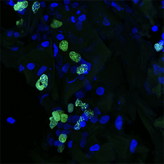 3d-cancer-fig2 3d-cancer-fig2