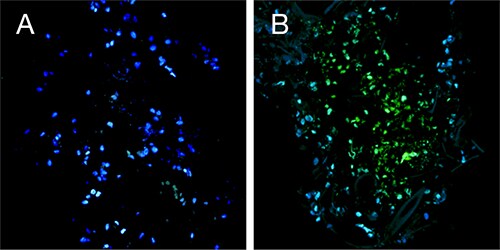 3d-cancer-fig3 3d-cancer-fig3