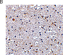 immunecheck-fig2b immunecheck-fig2b