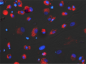 Endocytosis of DiI OxLDL by BPAECs Endocytosis of DiI OxLDL by BPAECs