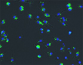 Accumulation of lipid droplets in RAW cells treated with OxLDL Accumulation of lipid droplets in RAW cells treated with OxLDL