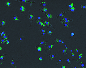 Accumulation of lipid droplets in RAW cells treated with OxLDL Accumulation of lipid droplets in RAW cells treated with OxLDL