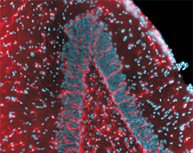 Microglial cells in a rat hippocampus cryosection labeled with DiI AcLDL Microglial cells in a rat hippocampus cryosection labeled with DiI AcLDL