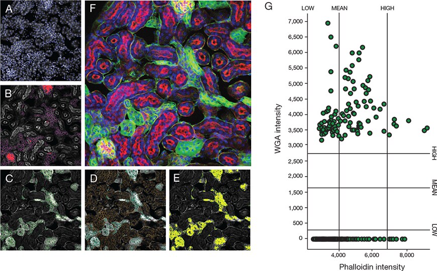 Confocal image analysis of a fluorescently stained mouse kidney Confocal image analysis of a fluorescently stained mouse kidney