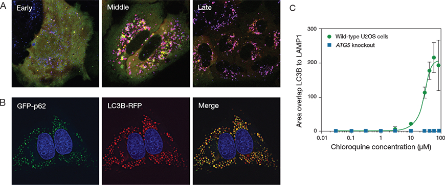 Detection of the autophagosomal marker LC3B Detection of the autophagosomal marker LC3B