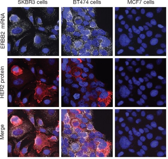 Use of the ViewRNA Cell Plus Assay to examine ERBB2 mRNA and HER2 protein Use of the ViewRNA Cell Plus Assay to examine ERBB2 mRNA and HER2 protein