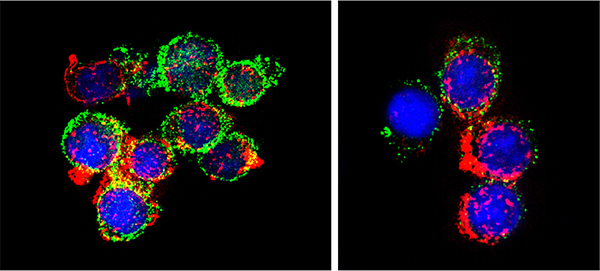 Immunofluorescence analysis of Jurkat cells using anti–CTLA-4 antibody Immunofluorescence analysis of Jurkat cells using anti–CTLA-4 antibody