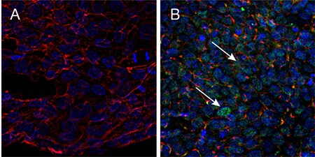 Acceleration by SOX9 of the differentiation of pluripotent stem cells Acceleration by SOX9 of the differentiation of pluripotent stem cells