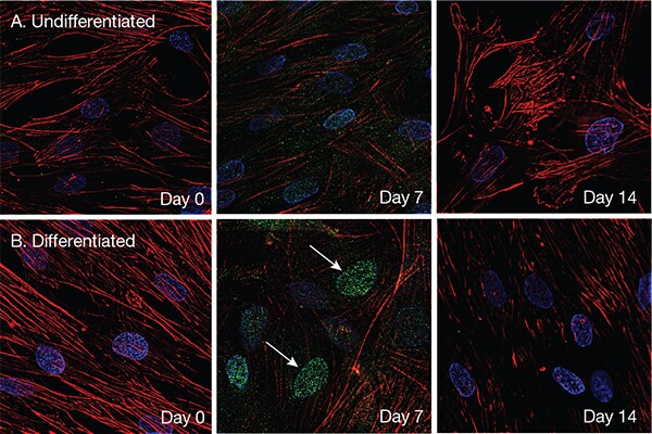 Activation by RUNX2 of osteoblast differentiation Activation by RUNX2 of osteoblast differentiation