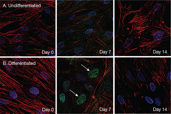 Activation by RUNX2 of osteoblast differentiation Activation by RUNX2 of osteoblast differentiation