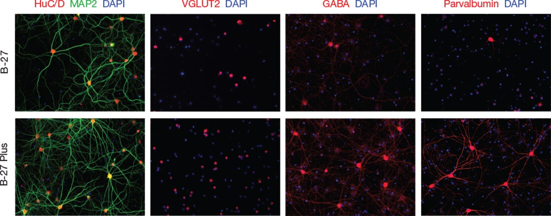 确定原代大鼠神经元培养物中的神经元亚型 确定原代大鼠神经元培养物中的神经元亚型