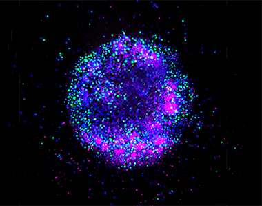 Natural killer (NK) cells invading breast cancer spheroids Natural killer (NK) cells invading breast cancer spheroids