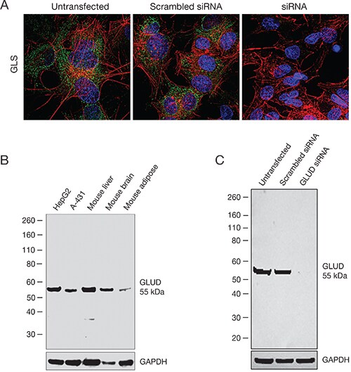 Confirmation of glutaminase (GLS) and glutamate dehydrogenase (GLUD) antibody specificity Confirmation of glutaminase (GLS) and glutamate dehydrogenase (GLUD) antibody specificity
