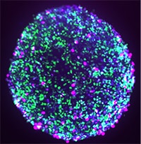 Spheroid cell culture: Practical solutions for frequently asked questions 3-fluorescent-color-stained-spheroid