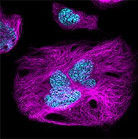 Watch the on-demand webinar "Best practices: 5 steps to live-cell imaging" fibroblast-cell-stained-with-blue-nuclear-dye-pink-cytoskeleton-probe