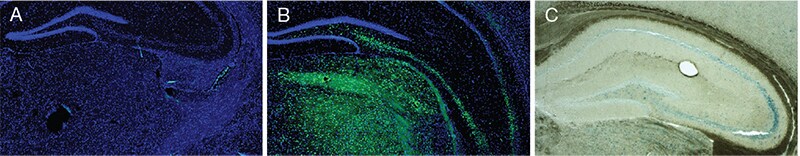 Figure 2. Cleavage of the CellEvent Senescence Green β-Gal substrate results in covalently bound green-fluorescent product. 3-brain-tissue-sections-stained-with-cellevent-senescence-green-probe-control-shows-no-senescent-cells